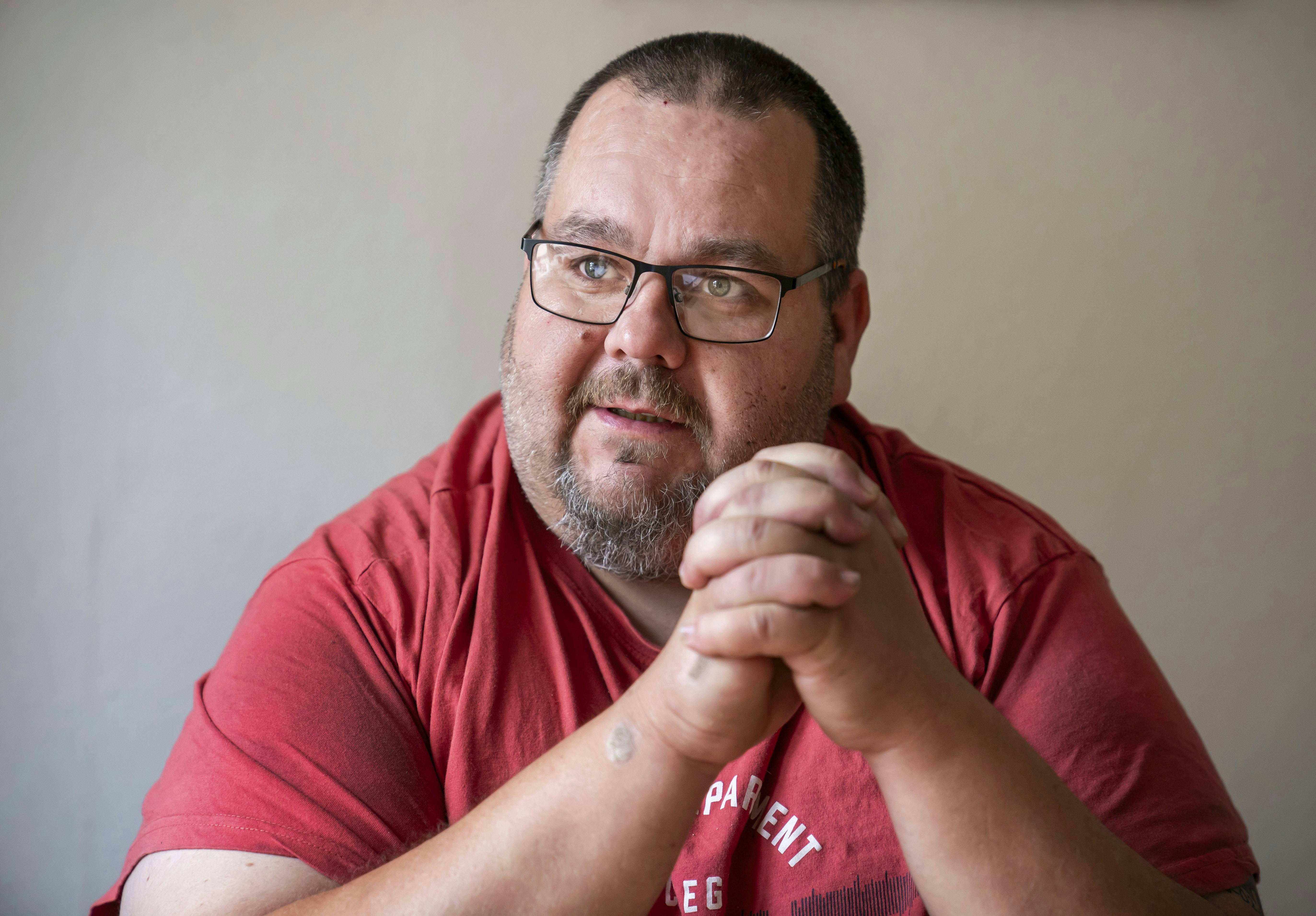 Sonny Fehrs har tabt sig med slankemedicin