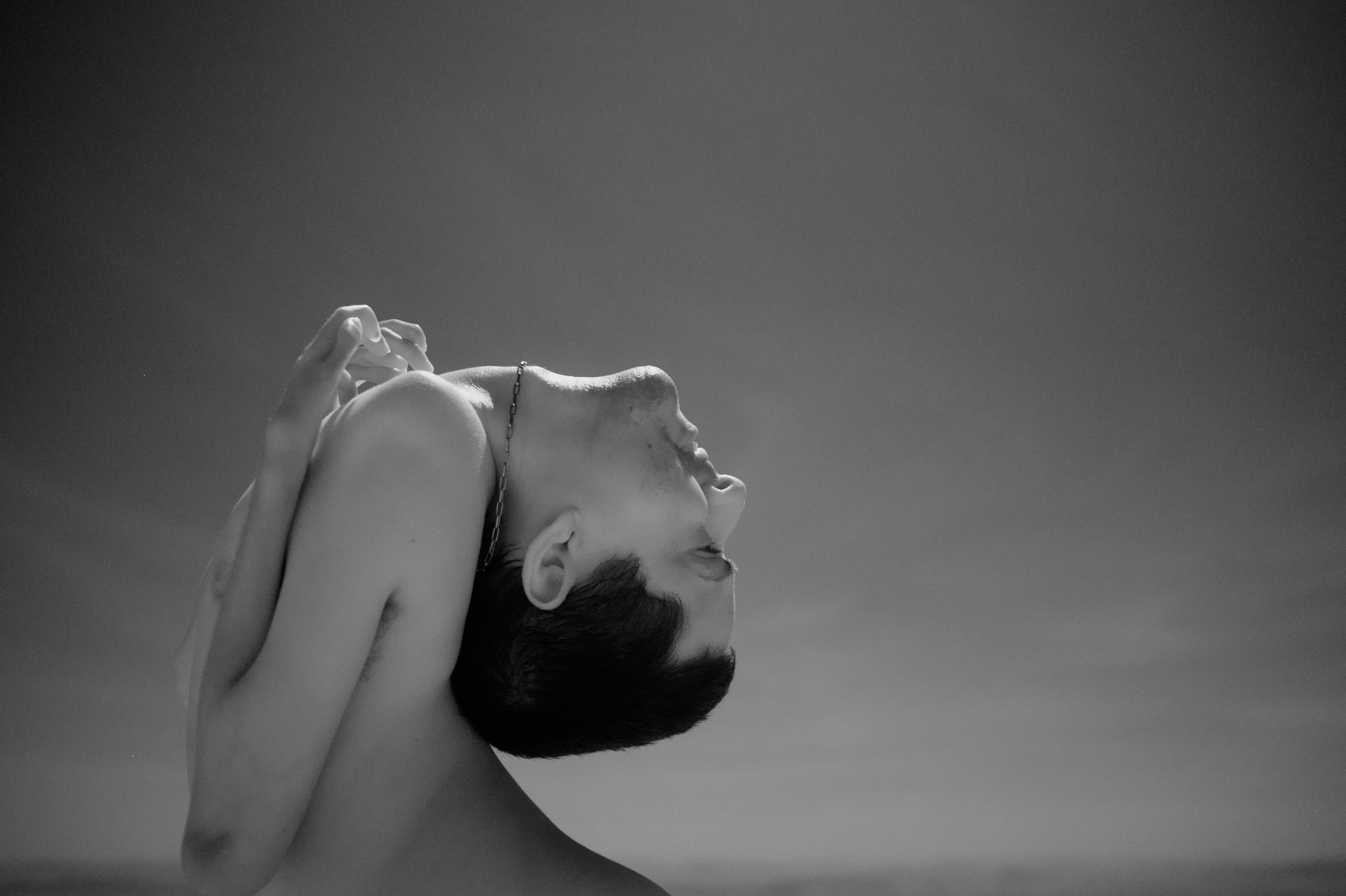 Claudio Vieira de Oliveira, 39, er født med sygdom, så hans hoved sidder ganske specielt.