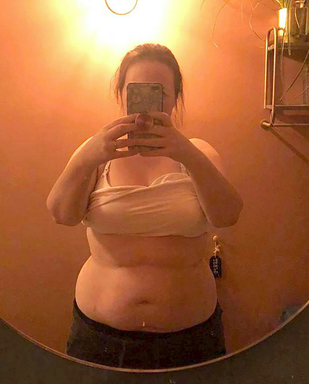 Før ville Ida helst ikke være med på billeder. Etter dette foto blev taget, har hun fået fjernet 33,3 liter betændt fedt.