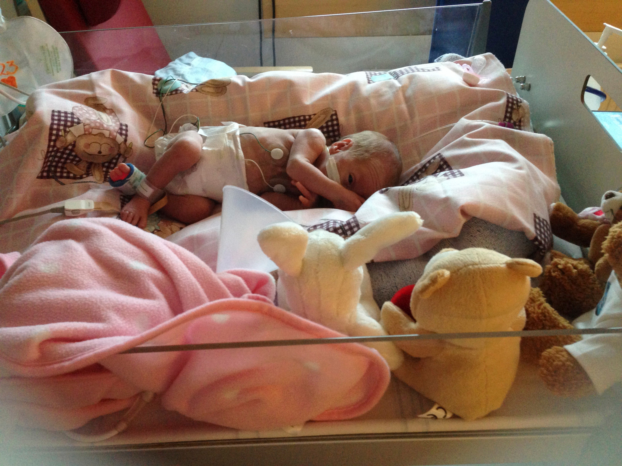 Lille Elsa blev født med en hjertefejl