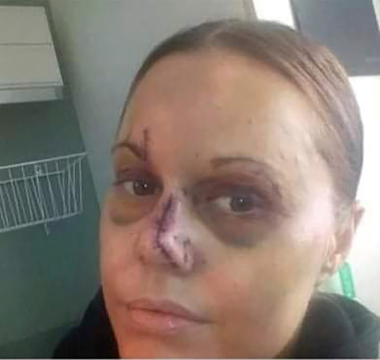 Vold og voldtægter har været en del af prisen for Fannys fascination af kriminelle ‘badboys’. – Der er ikke noget glamourøst ved den verden, advarer hun.