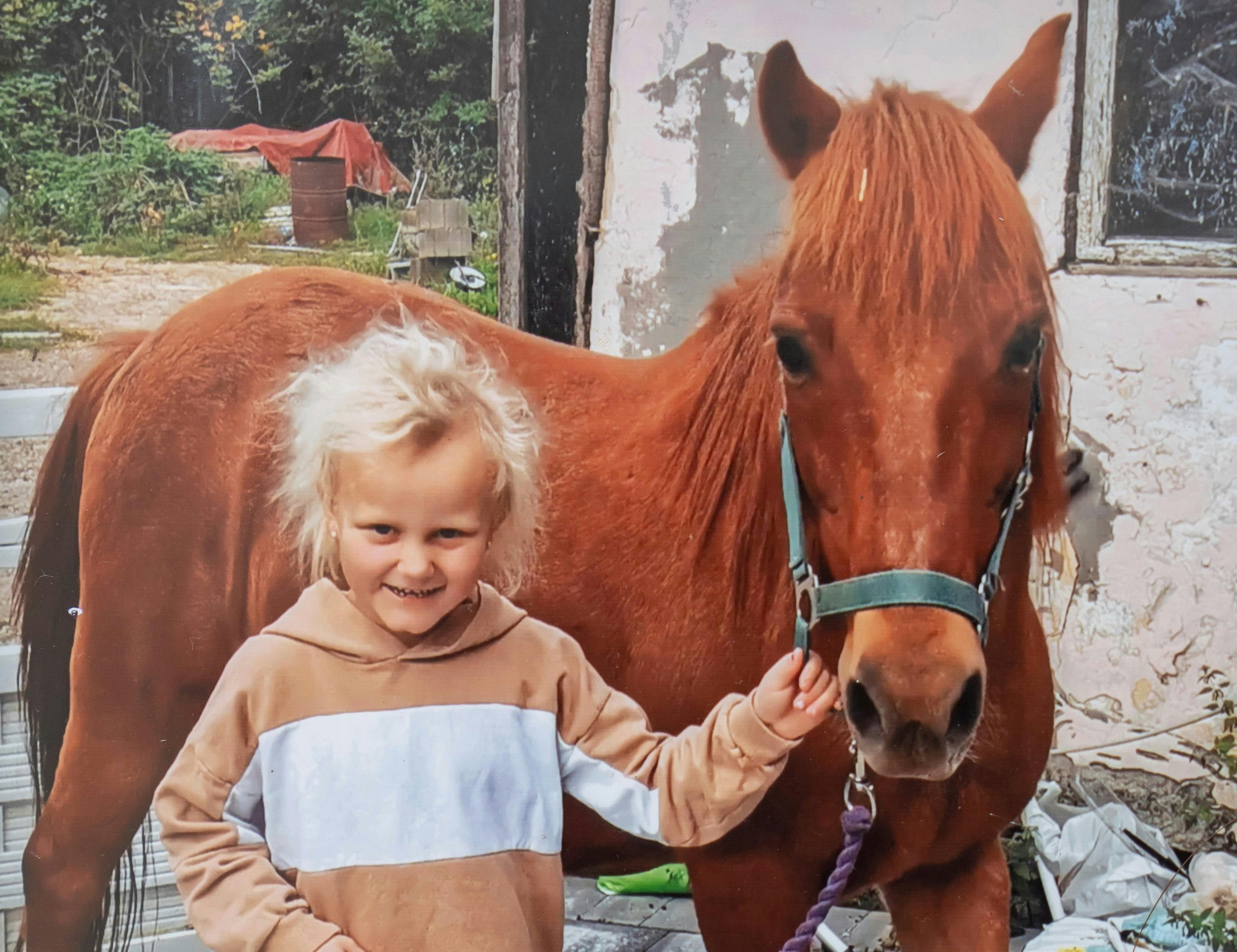 Emmalia på 9 år er ramt af hårtabslidelsen alopecia.