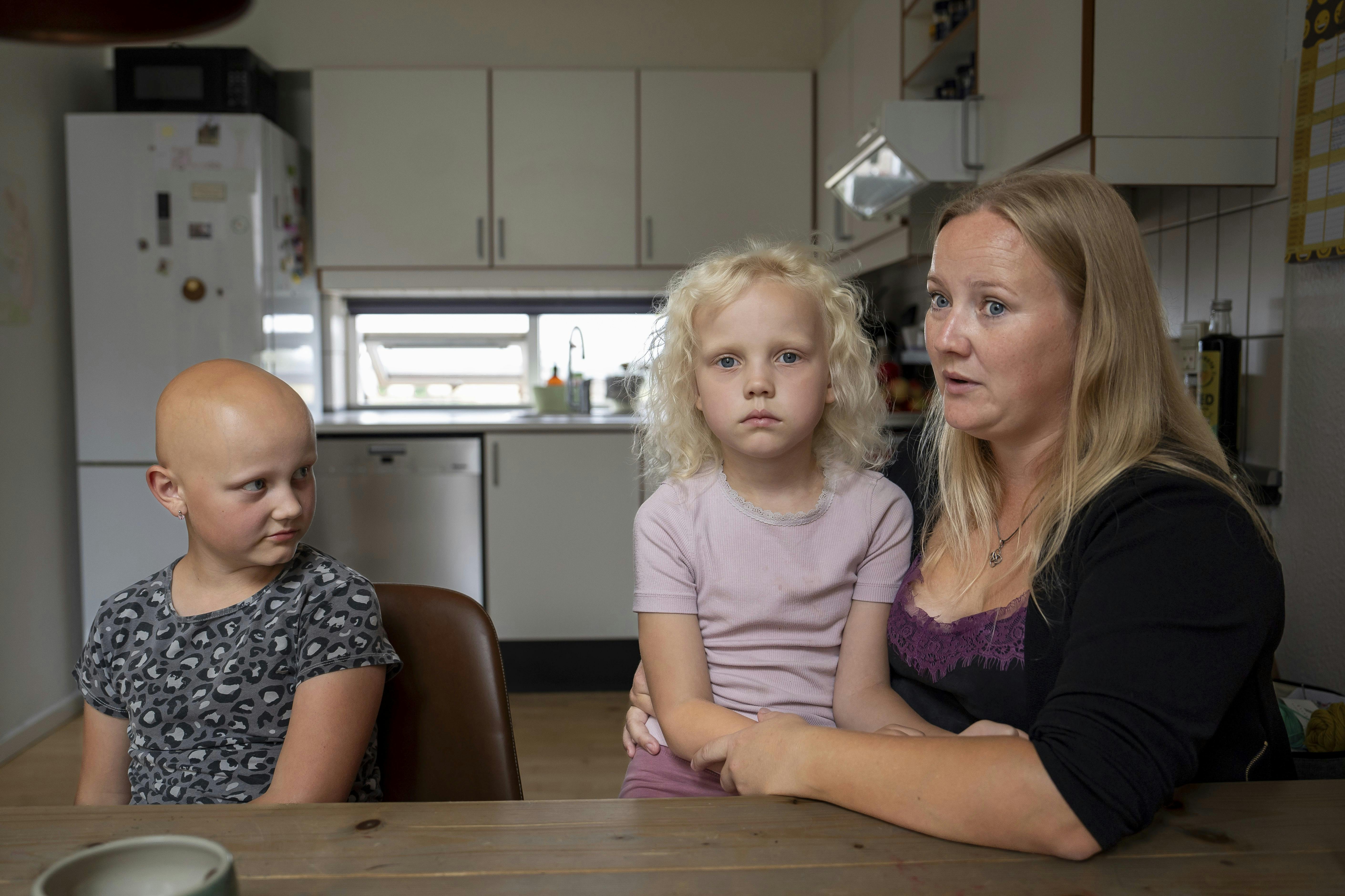 Emmalia på 9 år er ramt af hårtabslidelsen alopecia.