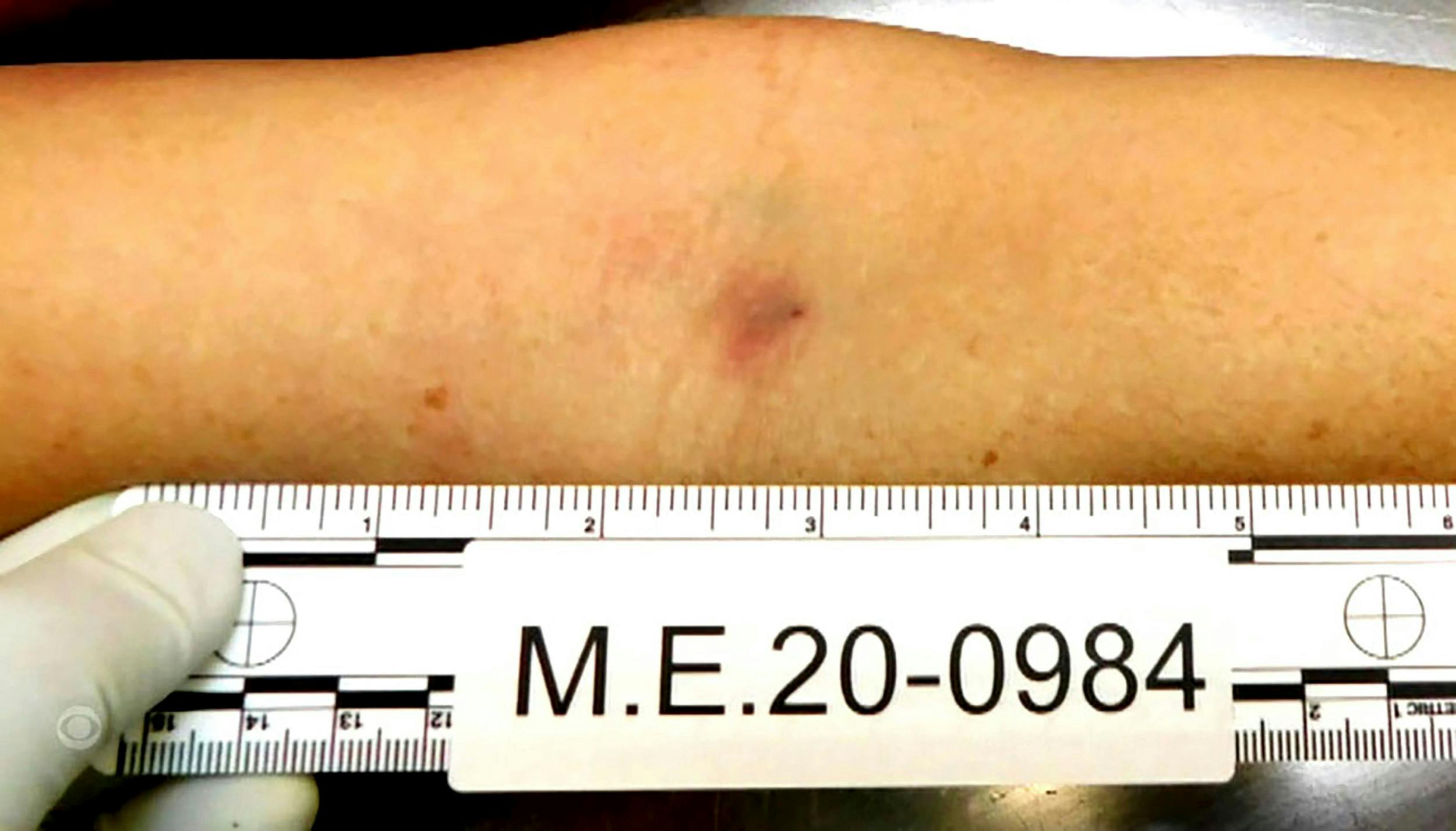 Et nålestik i afdøde Marias arm var med til at afsløre, at hun blev myrdet.