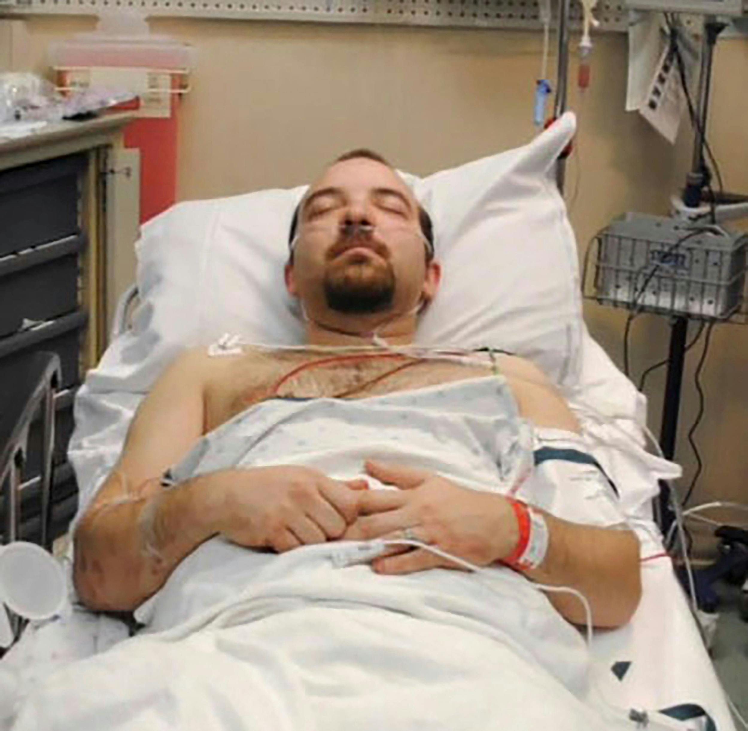 Nick Firkus måtte på hospitalet efter at have skudt sig selv i benet.