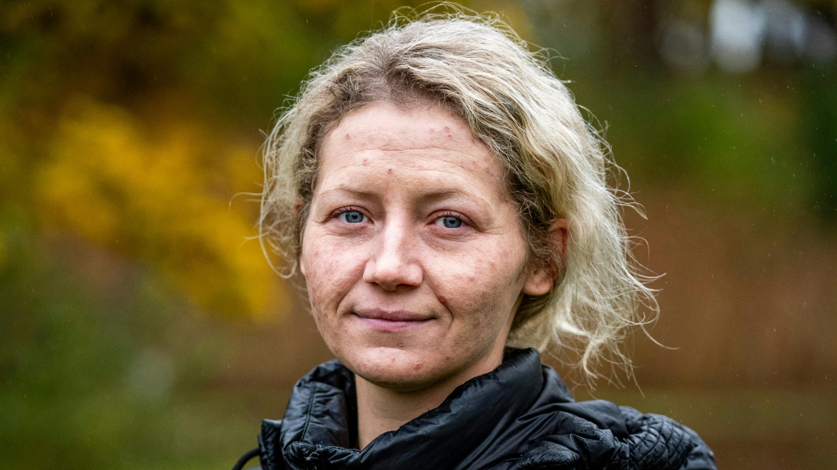 Annie Lund Klochmann Jensen mistede sin 1-årige søn til den sjældne og dødelige Krabbes sygdom