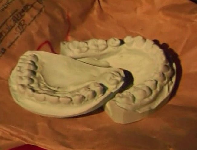 Mordet på Sharra Ferger - Sharra Fergers onkel Gary Cochrans tandaftryk