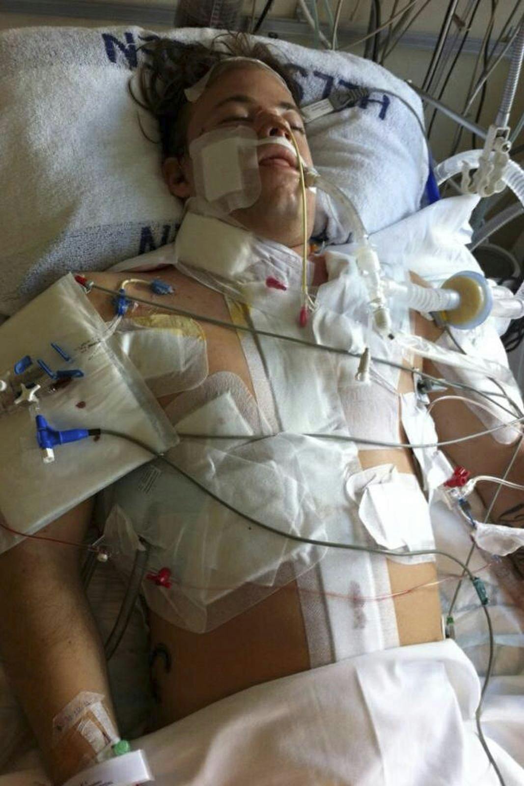 Marius Løkken fik 20 knivstik og overlevede. Her i hospitalssengen efter overfaldet.