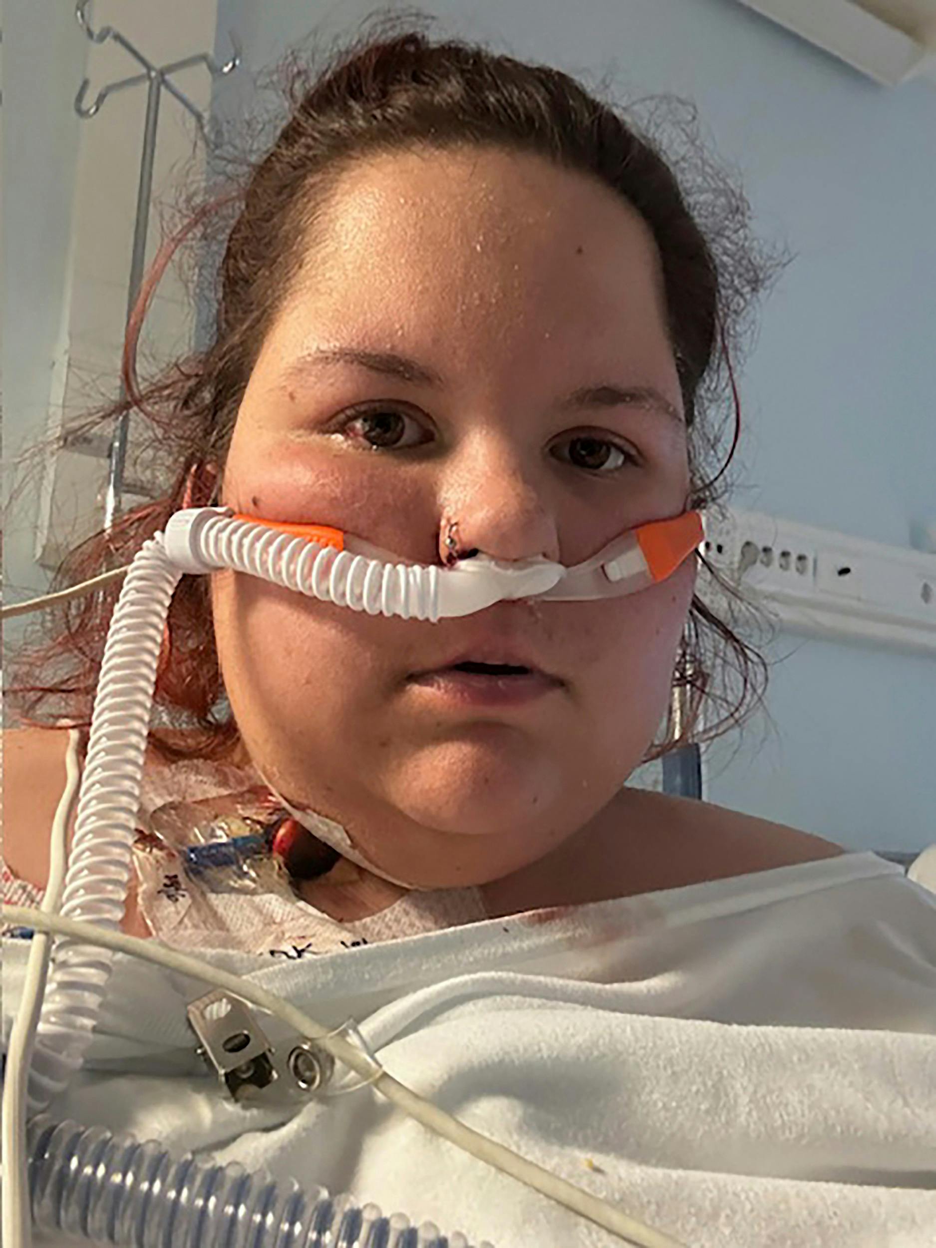 Magdalena kunne ikke selv trække vejret og måtte i respirator.  