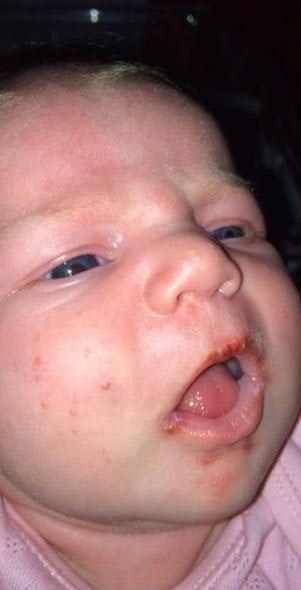 baby smittet med herbes