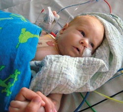 Strom blev født med fire hjertefejl - lægerne måtte operere ham da han var 2 måneder gammel baby
