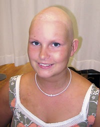 Anneli uden hår