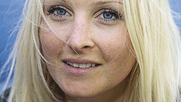Den 24-årige kvinde fra Frederiksberg har taget  kampen op mod lidelsen, der giver hende voldsomme mavesmerter.