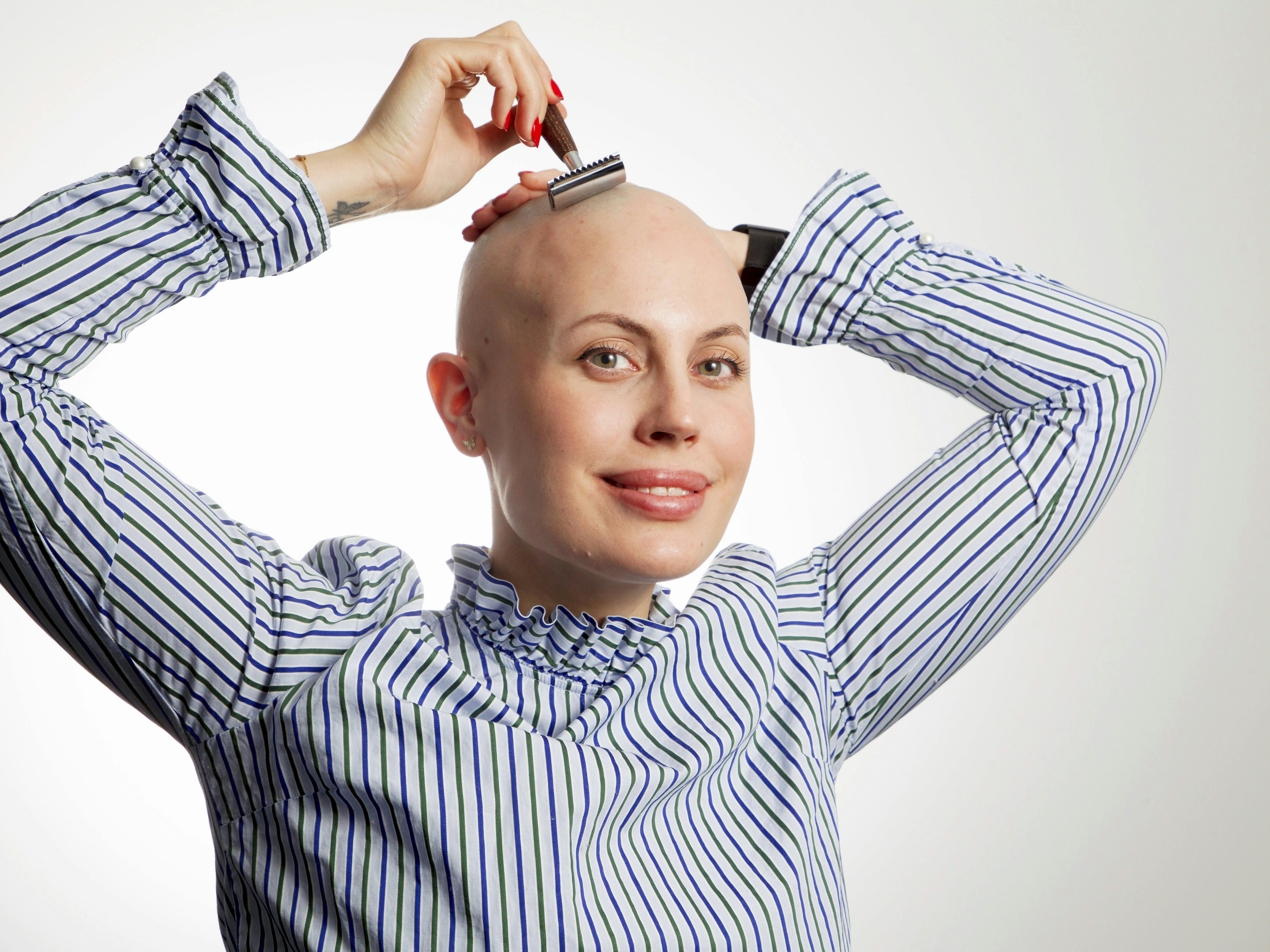 https://imgix.udeoghjemme.dk/media/article/julia_viita_fra_flateby_har_alopecia_14_of_20_0.jpg