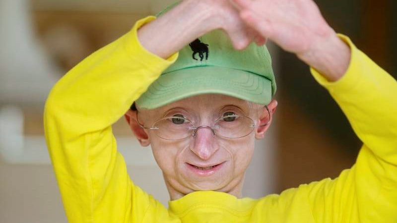 jesper progeria
