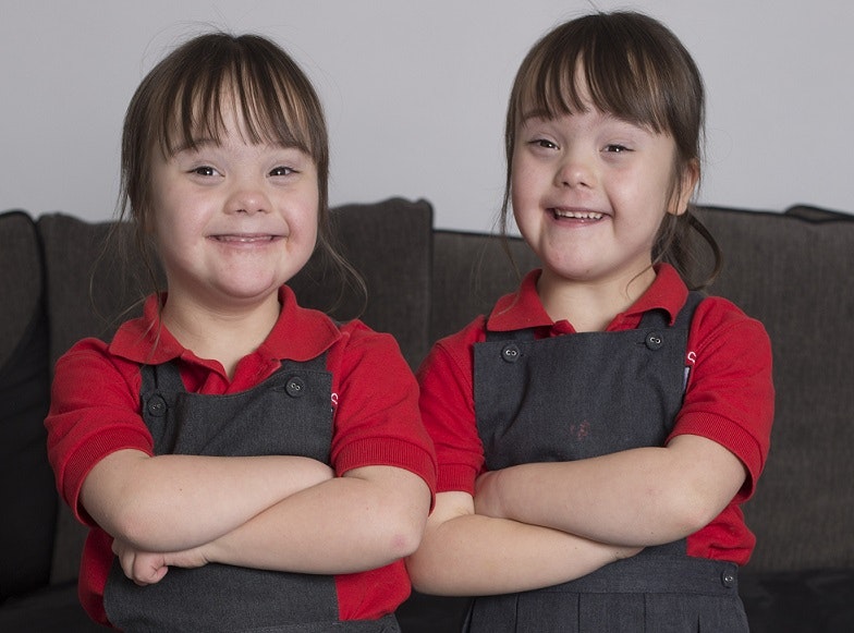 Enæggede tvillinger med Downs syndrom
